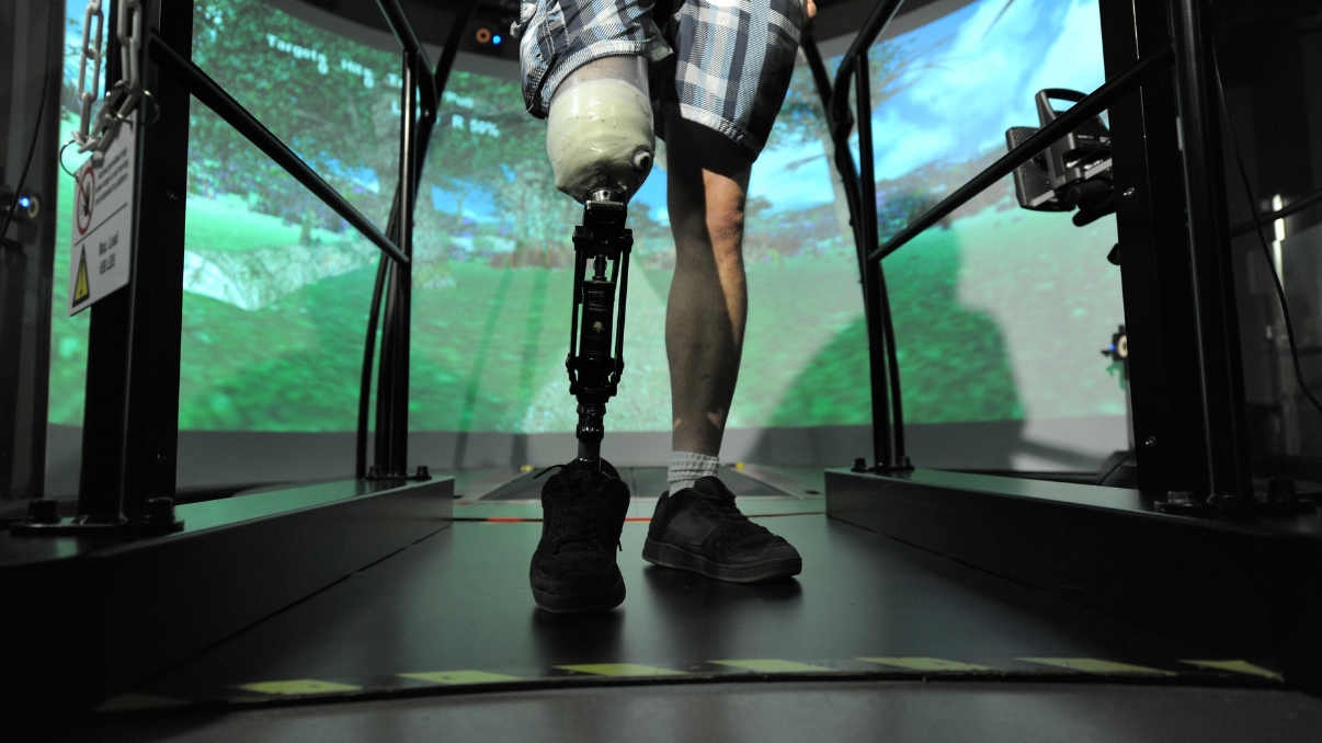 Lower leg amputee patient at the Glenrose uses the CAREN