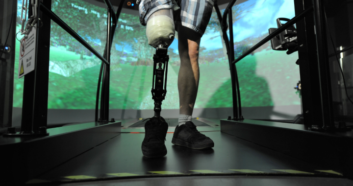 Lower leg amputee patient at the Glenrose uses the CAREN